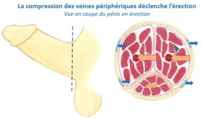 pénis solution urologie